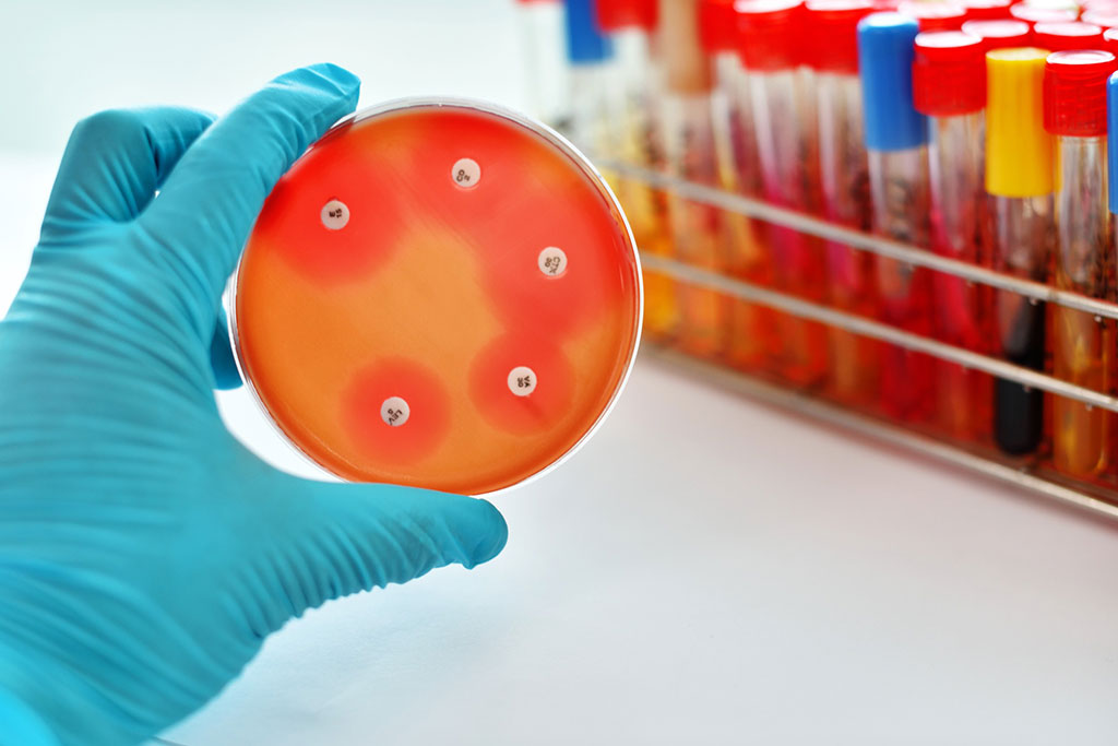 Antimicrobial Susceptibility